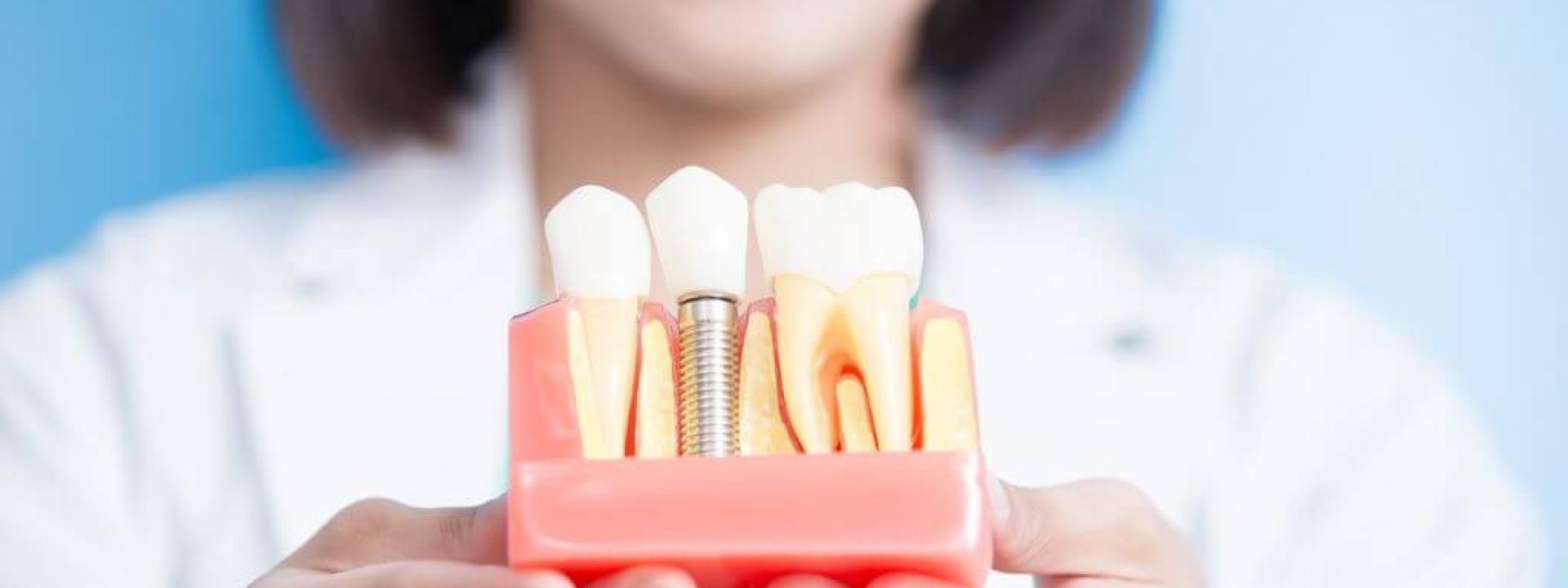 Addressing Failed Implants Addressing Failed Implants